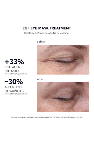 EFG Eye Mask Treatment